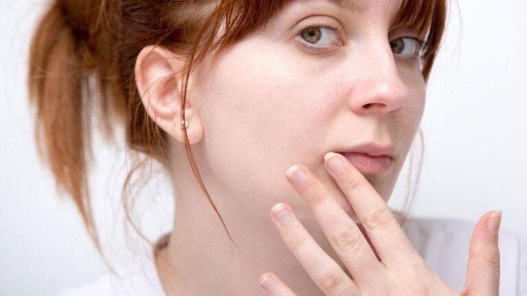 Uçuk deyip geçmeyin, bakın neye sebep oluyor