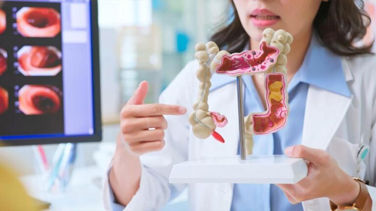 Kalın Bağırsak Görevi Nedir? Kalın Bağırsak Fonksiyonları ve Özellikleri Nelerdir?