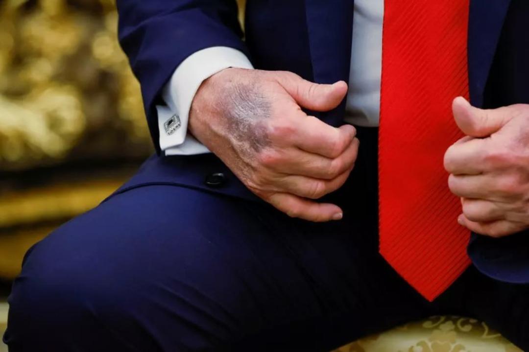 Sosyal medyanın konuştuğu ifadesi! Dünya Trump hakkında konuşuyor: ortada hayır ... eldeki çürük dikkat çekti 3