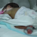 Türkiye’de Bebeklerin Yüzde 13’ü Erken Doğuyor