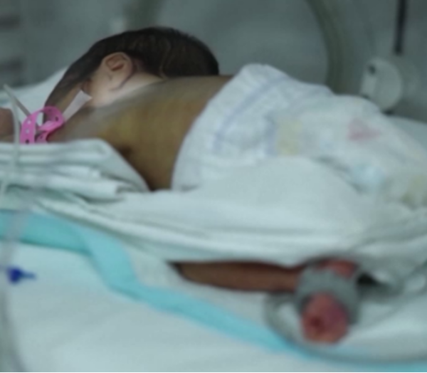 Türkiye’de Bebeklerin Yüzde 13’ü Erken Doğuyor