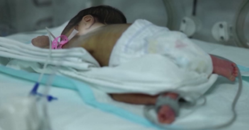 Türkiye’de Bebeklerin Yüzde 13’ü Erken Doğuyor